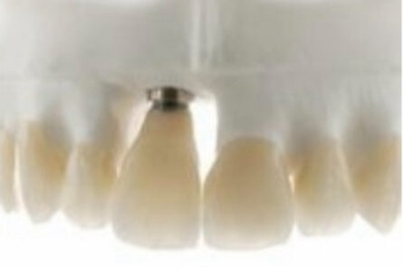 Smile Gallery. Dentist in Beverly Hills, CA. Dr. Hessam Nowzari, D.D.S., Ph.D., Dr. Eric Cho, D.D.S. Hessam Nowzari DDS, PHD