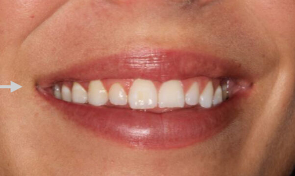 Smile Gallery. Dentist in Beverly Hills, CA. Dr. Hessam Nowzari, D.D.S., Ph.D., Dr. Eric Cho, D.D.S. Hessam Nowzari DDS, PHD