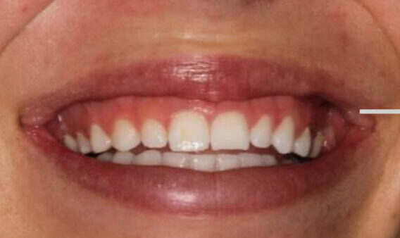 Smile Gallery. Dentist in Beverly Hills, CA. Dr. Hessam Nowzari, D.D.S., Ph.D., Dr. Eric Cho, D.D.S. Hessam Nowzari DDS, PHD