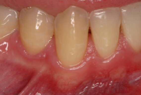 Smile Gallery. Dentist in Beverly Hills, CA. Dr. Hessam Nowzari, D.D.S., Ph.D., Dr. Eric Cho, D.D.S. Hessam Nowzari DDS, PHD