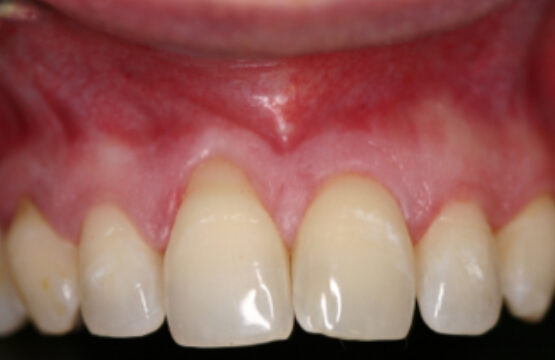 Smile Gallery. Dentist in Beverly Hills, CA. Dr. Hessam Nowzari, D.D.S., Ph.D., Dr. Eric Cho, D.D.S. Hessam Nowzari DDS, PHD
