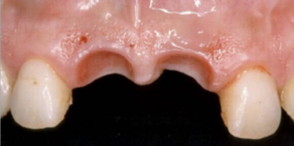 Smile Gallery. Dentist in Beverly Hills, CA. Dr. Hessam Nowzari, D.D.S., Ph.D., Dr. Eric Cho, D.D.S. Hessam Nowzari DDS, PHD