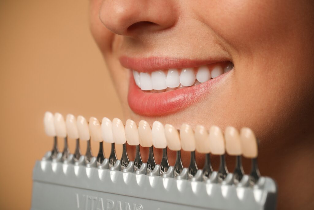 Dental veneers Beverly Hills